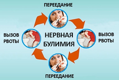 Лечение булимии в Сураже